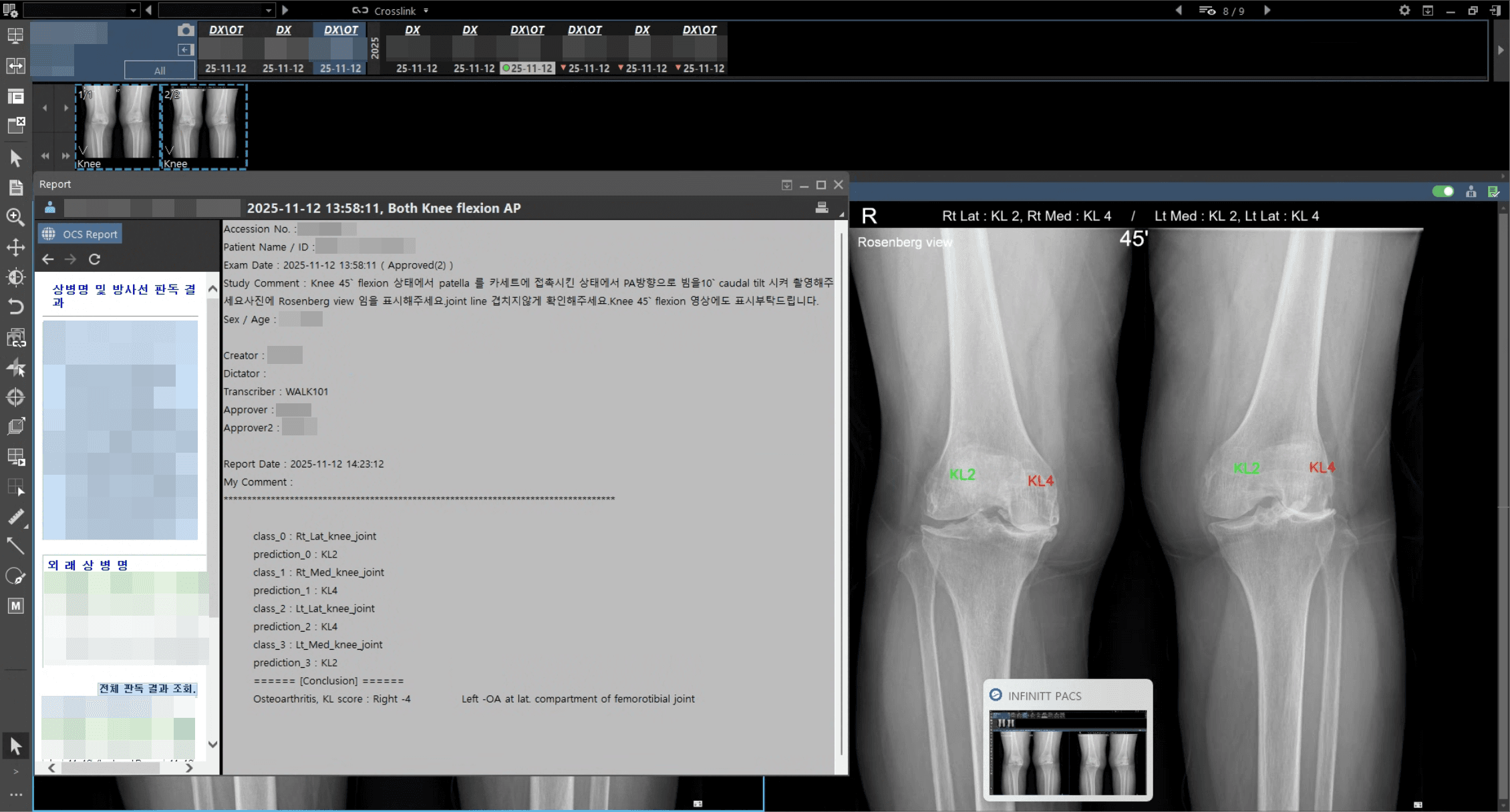 INFINITT PACS integration