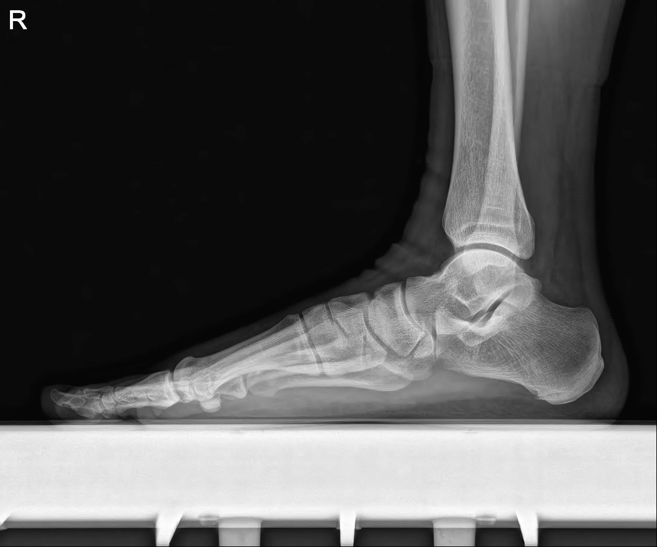 Foot LAT original