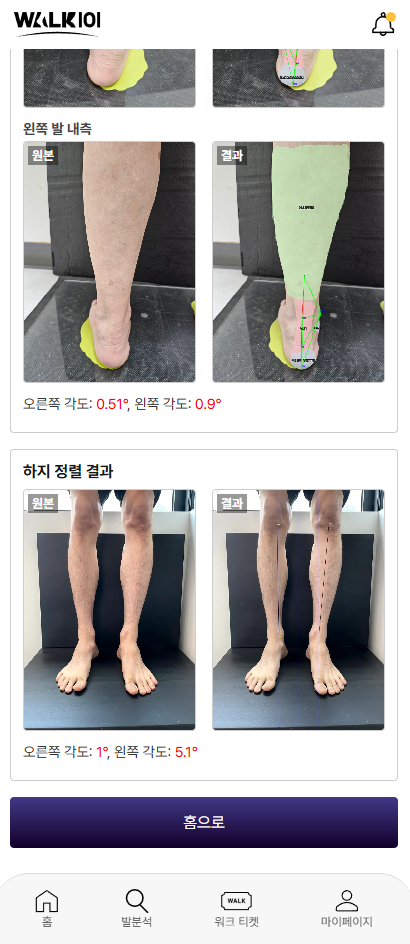 하지 정렬